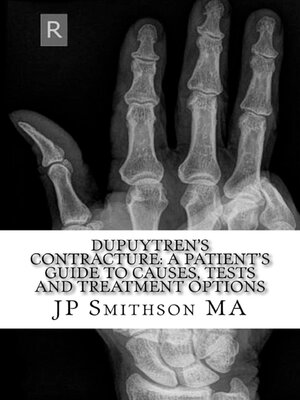 cover image of Dupuytren's Contracture